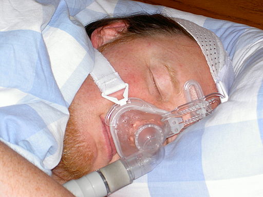 Obstructive sleep apnea solutions