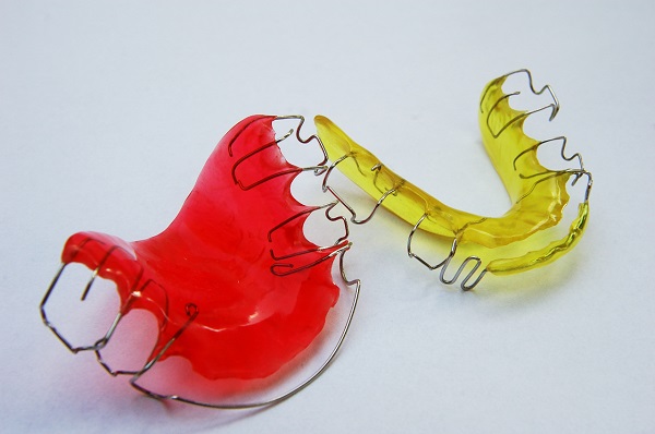 how to fix an overbite retainers