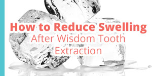 how to reduce swelling after tooth extraction