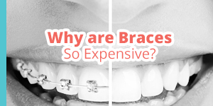 expensive braces