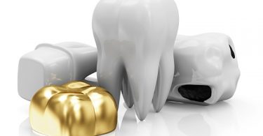 dental crown next to teeth