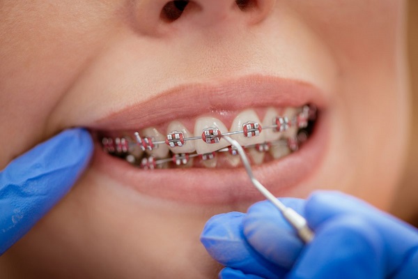 dentist checking braces
