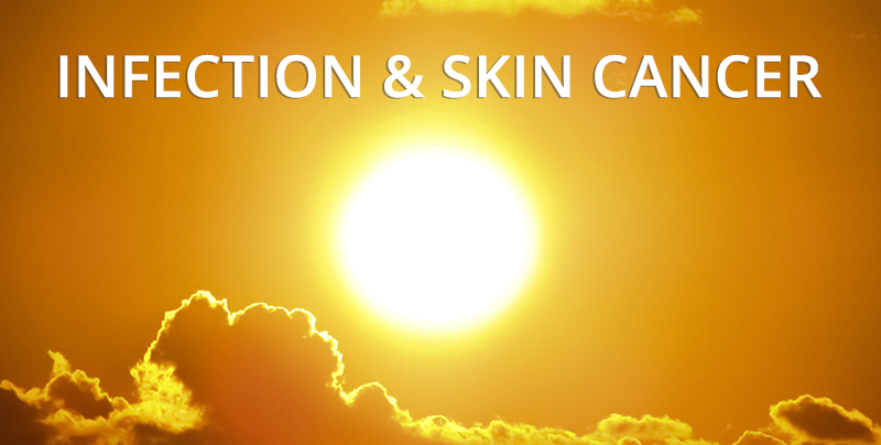 Infection and Skin Cancer as a result of sun poisoning